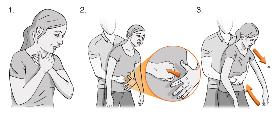 HEIMLICH