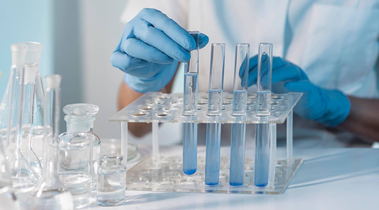 BIOQUIMICA ENFERMERÍA GRUPO A