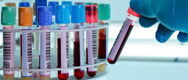 Bioquimica