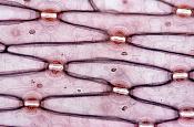 epidermis