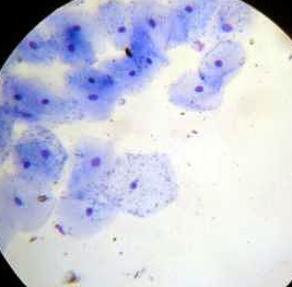 Células mucosa bucal