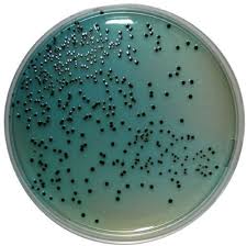 Agar-hektoenasal